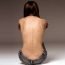 Anorexia