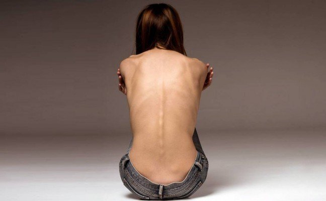 Anorexia