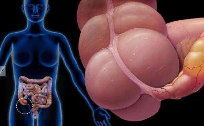 Are fibroids dangerous?