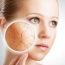 Can I use talcum powder to keep my skin dry?