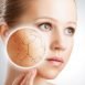 Can I use talcum powder to keep my skin dry?