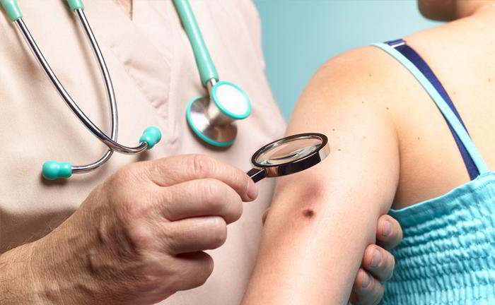 Can sunbathing cause skin cancer?