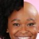 Can women go bald?