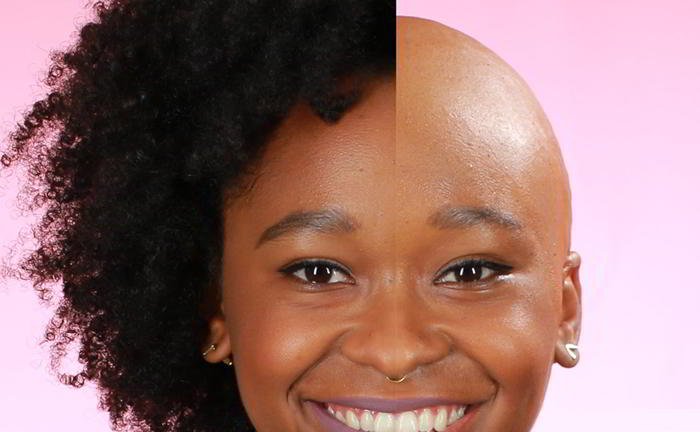 Can women go bald?