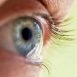 How are cataracts formed and hoe can they be prevented?