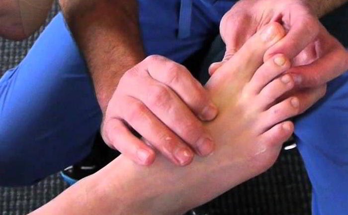 How can a bunions cured?