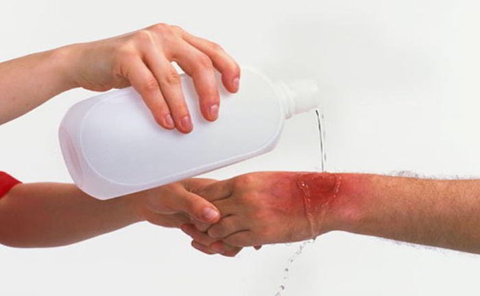 How can burn be treated?