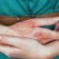 How can I take bath if my arm is fractured?