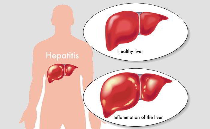 How can we differ Hepatitis A from Hepatitis B?