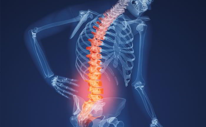How can we prevent osteoporosis?
