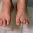 How is gangrene cured?