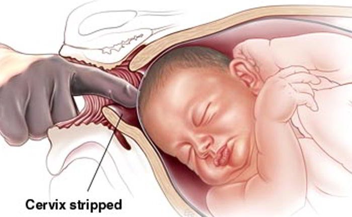How is induction done?