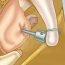 How is otosclerosis?