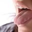 How to Cure Burning Tongue at Home Naturally?