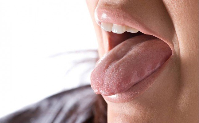 How to Cure Burning Tongue at Home Naturally?