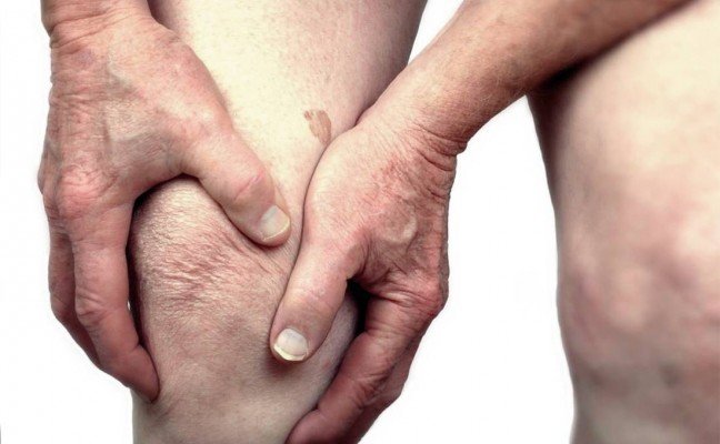 How to Cure Bursitis at Home Naturally?