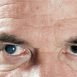How to Cure Cataract at Home Naturally?