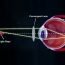 How to Cure Defective Vision at Home Naturally?