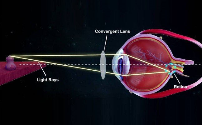 How to Cure Defective Vision at Home Naturally?