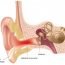 How to Cure Ear Infection at Home Naturally?