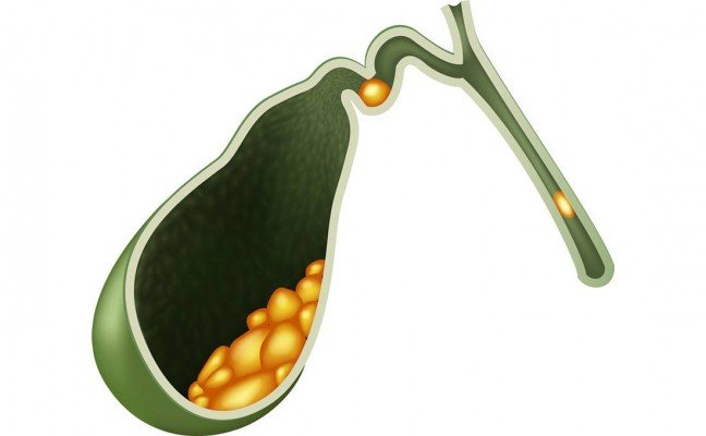 How to Cure Gall Bladder Disorders at Home Naturally?