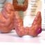 How to Cure Goitre at Home Naturally?
