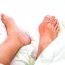 How to Cure Gout at Home Naturally?