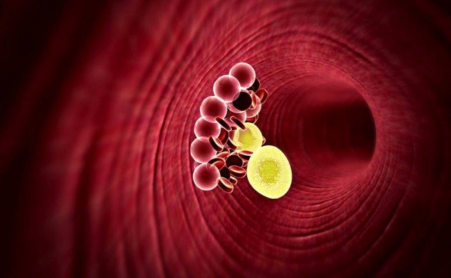 How to Cure High Blood Cholesterol at Home Naturally?