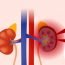 How to Cure Nephritis at Home Naturally?
