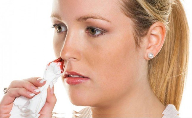 How to Cure Nose Bleeding at Home Naturally? How to Cure Nose Bleeding at Home Naturally?