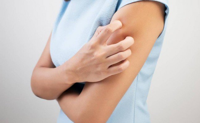 How to Cure Ringworm Infection Naturally?