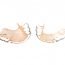 How to Cure Staining of Teeth and Lip Shading Natu