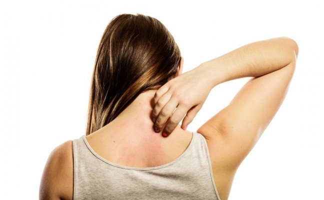 How to get rid of Body Rash at Home Naturally?