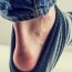 How to Get Rid of Chafing at Home Naturally?