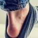 How to Get Rid of Chafing at Home Naturally?