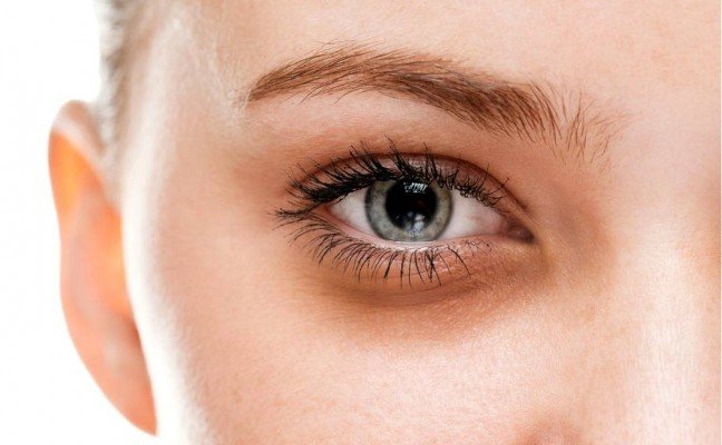 How to get rid of Dark Circles at Home Naturally?