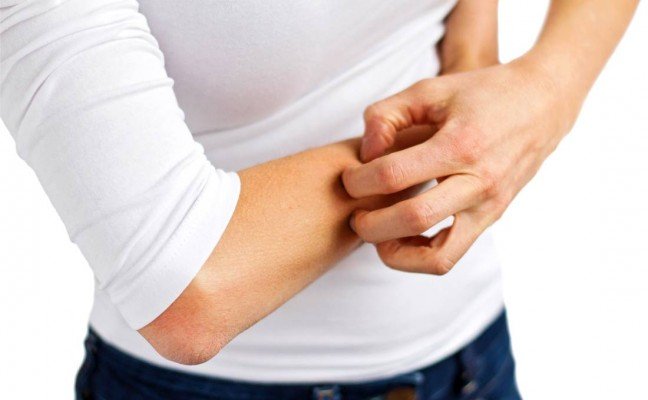 How to get rid of Itching Naturally?