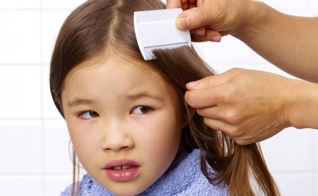 How to get rid of Lice at Home Naturally? How to get rid of Lice at Home Naturally?