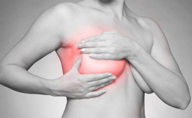 How to get rid of Mastitis at Home Naturally? How to get rid of Mastitis at Home Naturally?