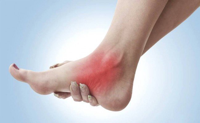 How to Get Rid of Sprain at Home Naturally? How to Get Rid of Sprain at Home Naturally?