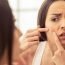 How to Remove Pimples Naturally and Permanently?