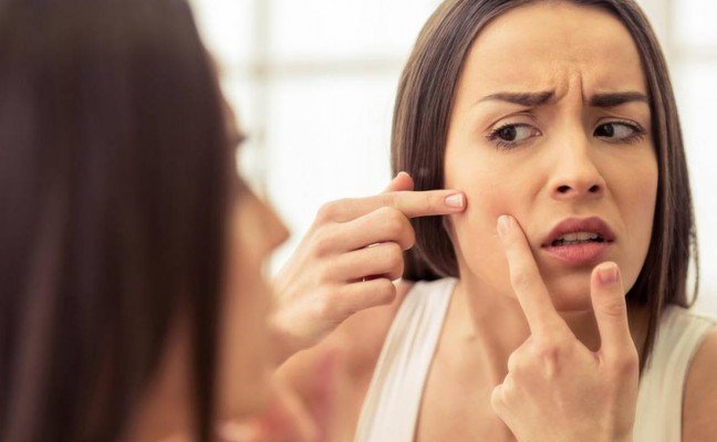 How to Remove Pimples Naturally and Permanently? How to Remove Pimples Naturally and Permanently?
