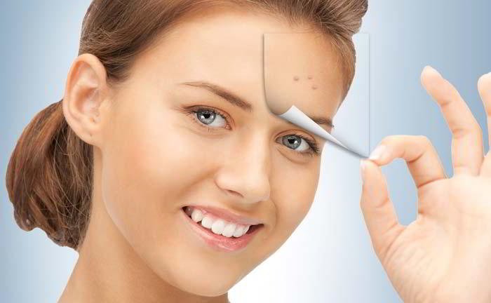 How to treat acne?