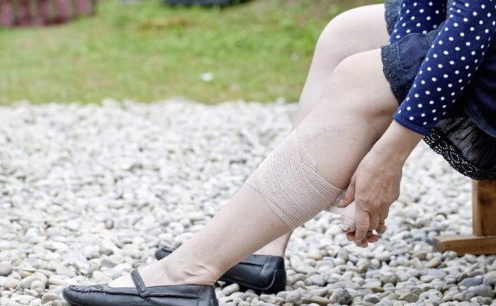 I am afraid that even after the treatment, the varicose veins may recur?