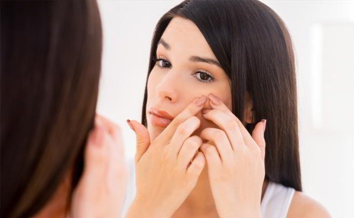 I had acne since long but it go better when I got pregnant but now again I have it. What is the reason?
