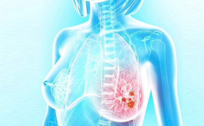 I have got mammography done and after the tests I was asked to go back. I am quite tense as I think I have cancer.
