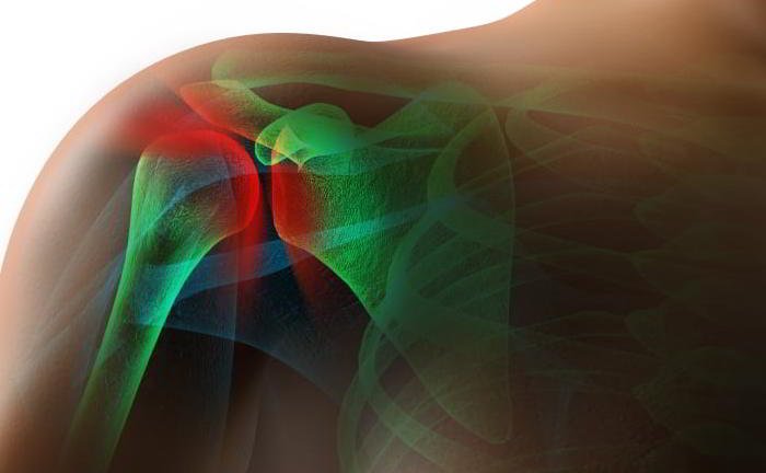 I still experience lot of pain in my shoulders although its quite some time now since I fractured them. Why is it taking so much time?