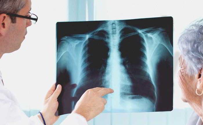 Is pneumonia dangerous?