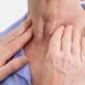 Is the cancer of thyroid common?