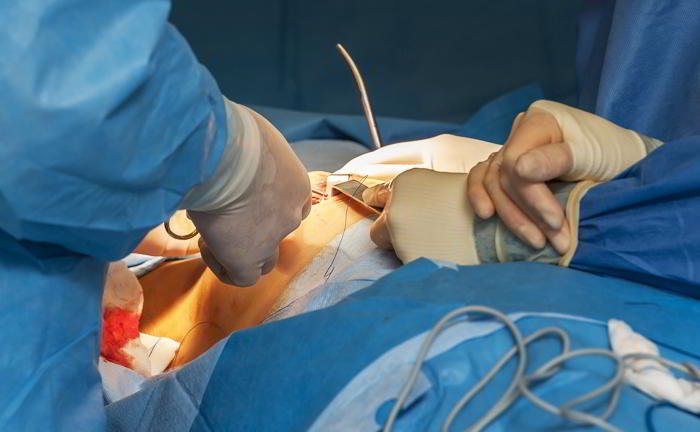 My doctor has told me to take hormones after my operation for breast cancer. Do I need to take them?